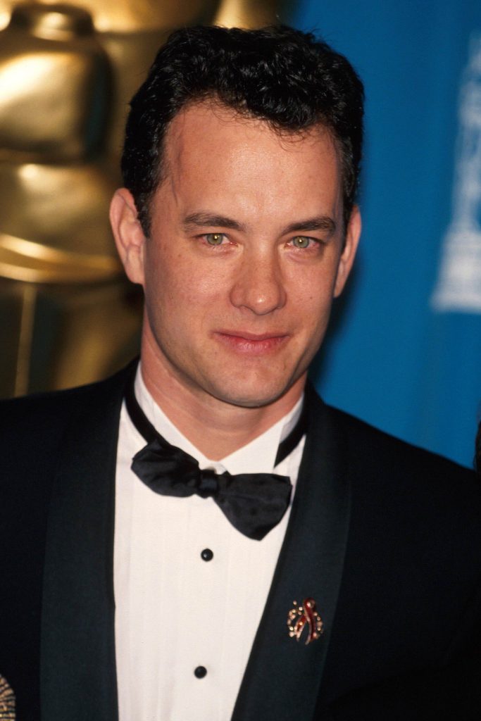 Hair Transplantation Of Tom Hanks